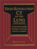 HRCT of the lung